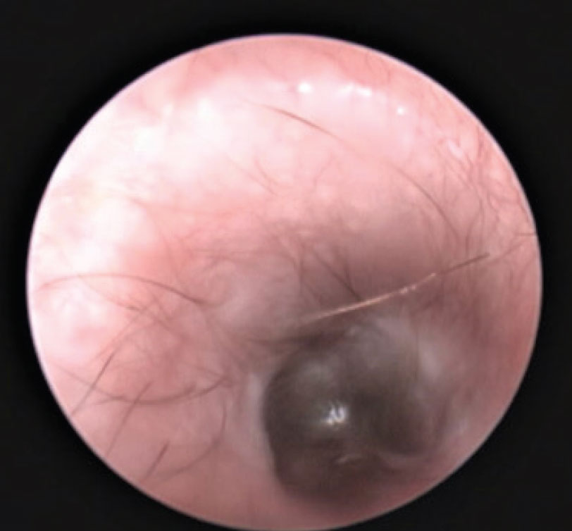 fig3