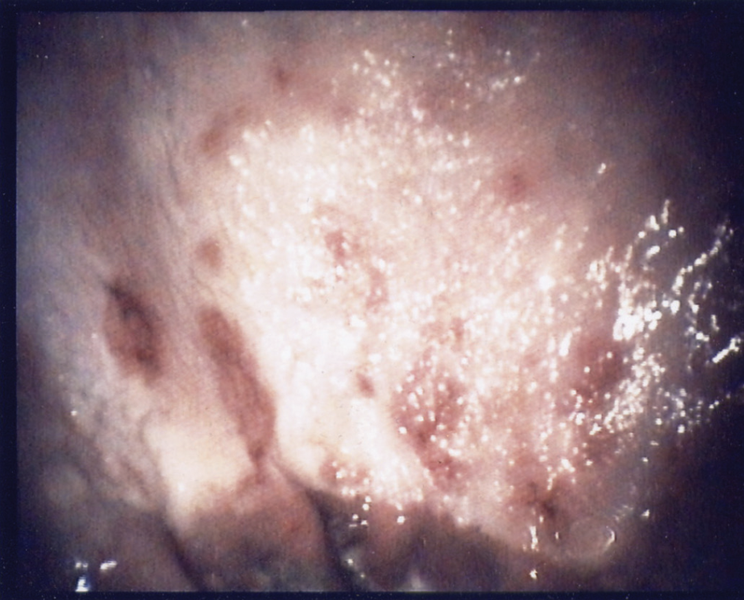fig2