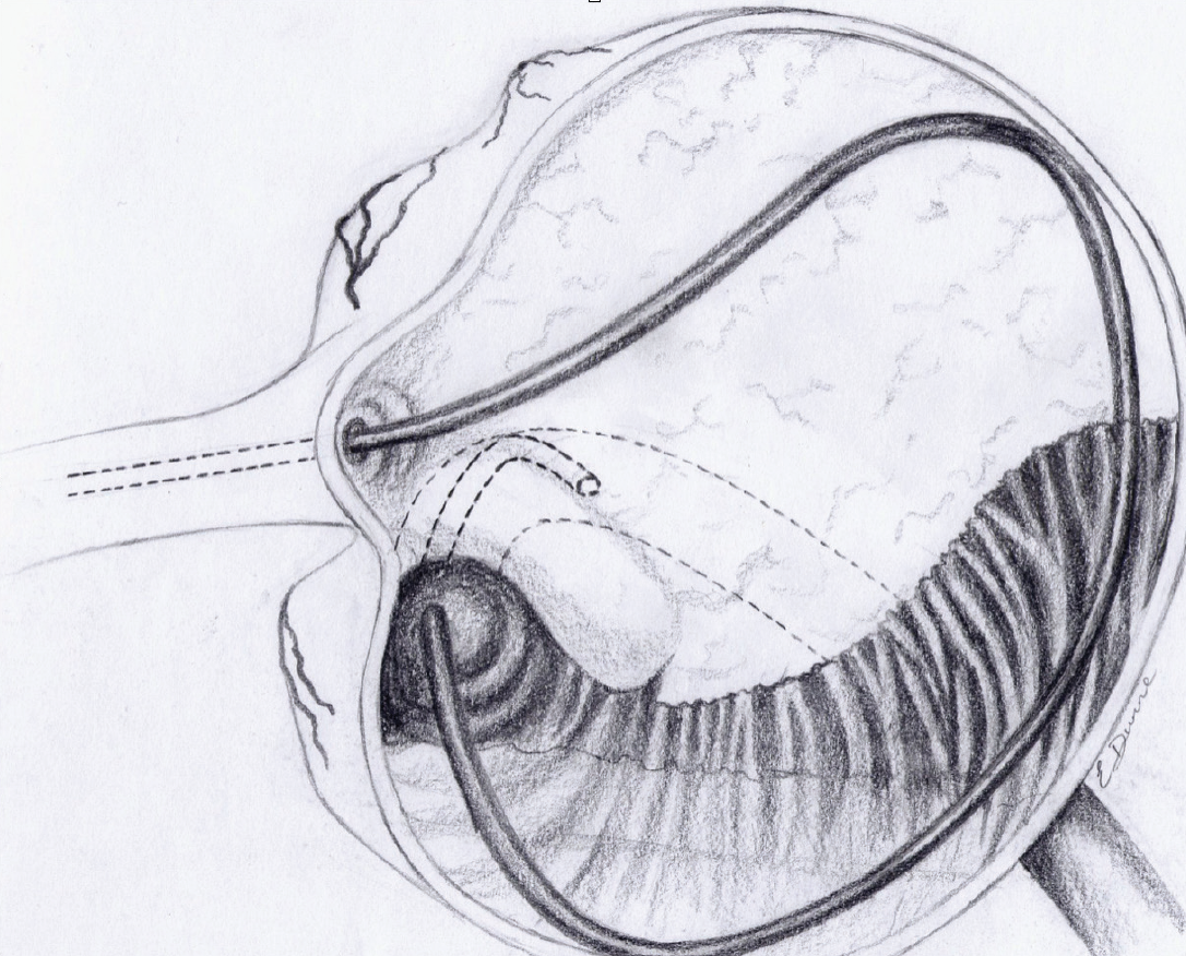 fig3
